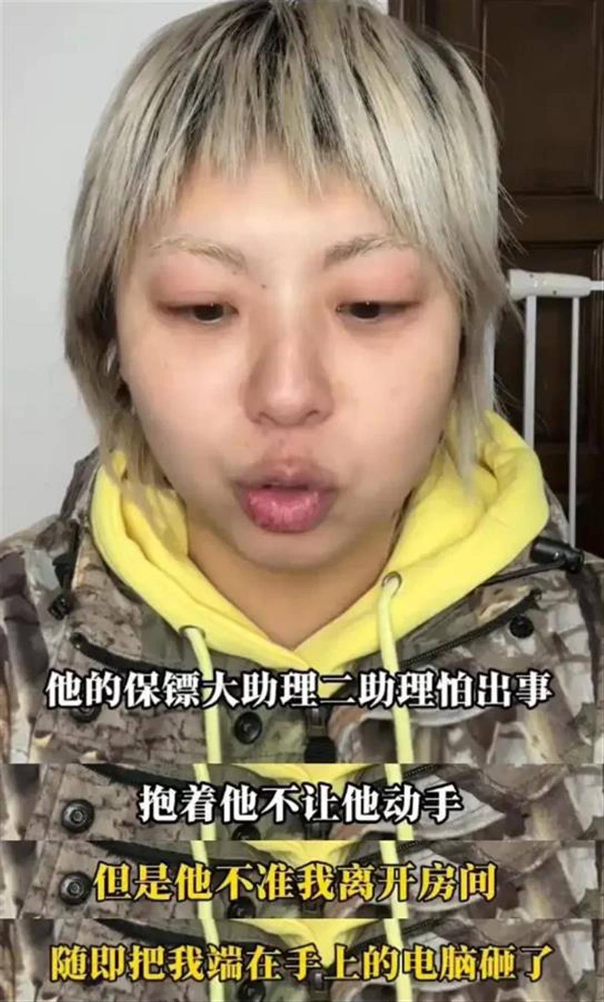 自称被殴打的工作人员回应无忧传媒声明，张大大签约的是一家什么公司？